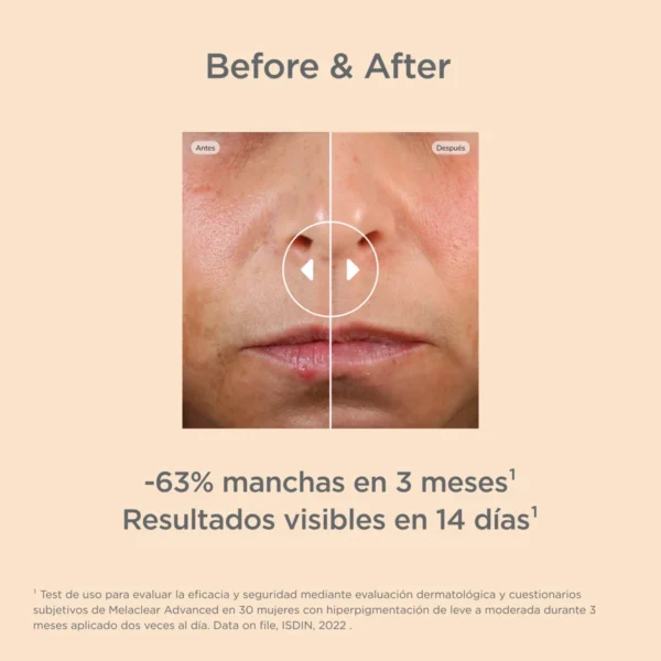Isdinceutics Melaclear Advanced Sérum - ISDIN - Imagen 6